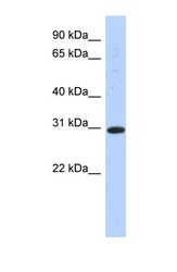 NBP1-58147 - 14-3-3 protein sigma / SFN